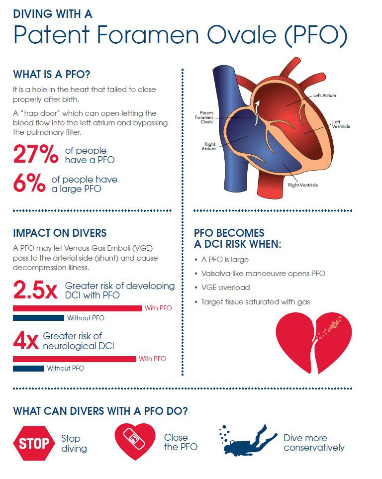Diving with a pfo fact sheet